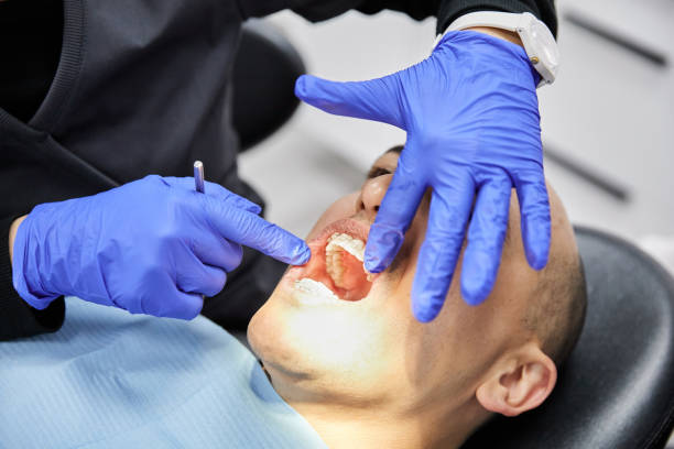 Best Emergency Care for Gum Disease in Lake Junaluska, NC